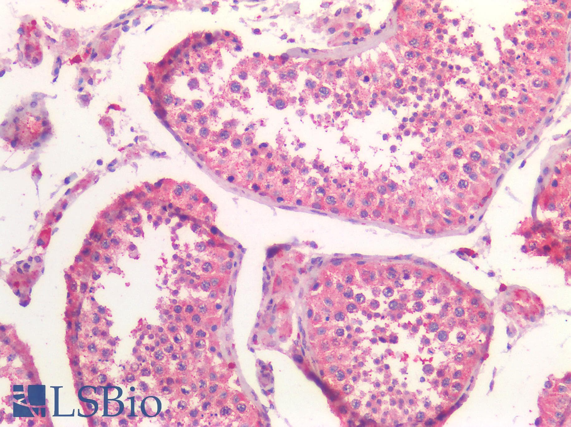 IHC-plus™ Polyclonal Rabbit anti-Human CKAP5 / ch-TOG Antibody (IHC, IF, WB)