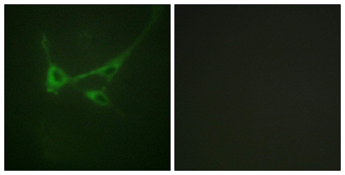 Polyclonal Rabbit anti-Human MTOR Antibody (phospho-Ser2481, IHC, IF)