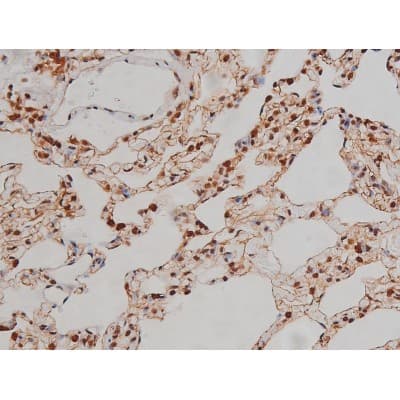 IGF1R / IGF1 Receptor Antibody (phospho-Tyr1346)