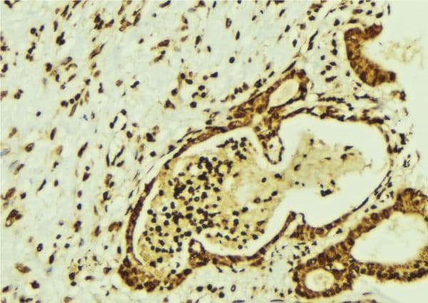 CBFB Antibody
