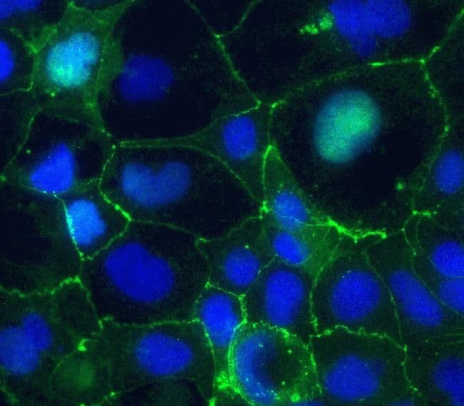 CLDN5 / Claudin 5 Antibody (clone 4C3C2, AF488)