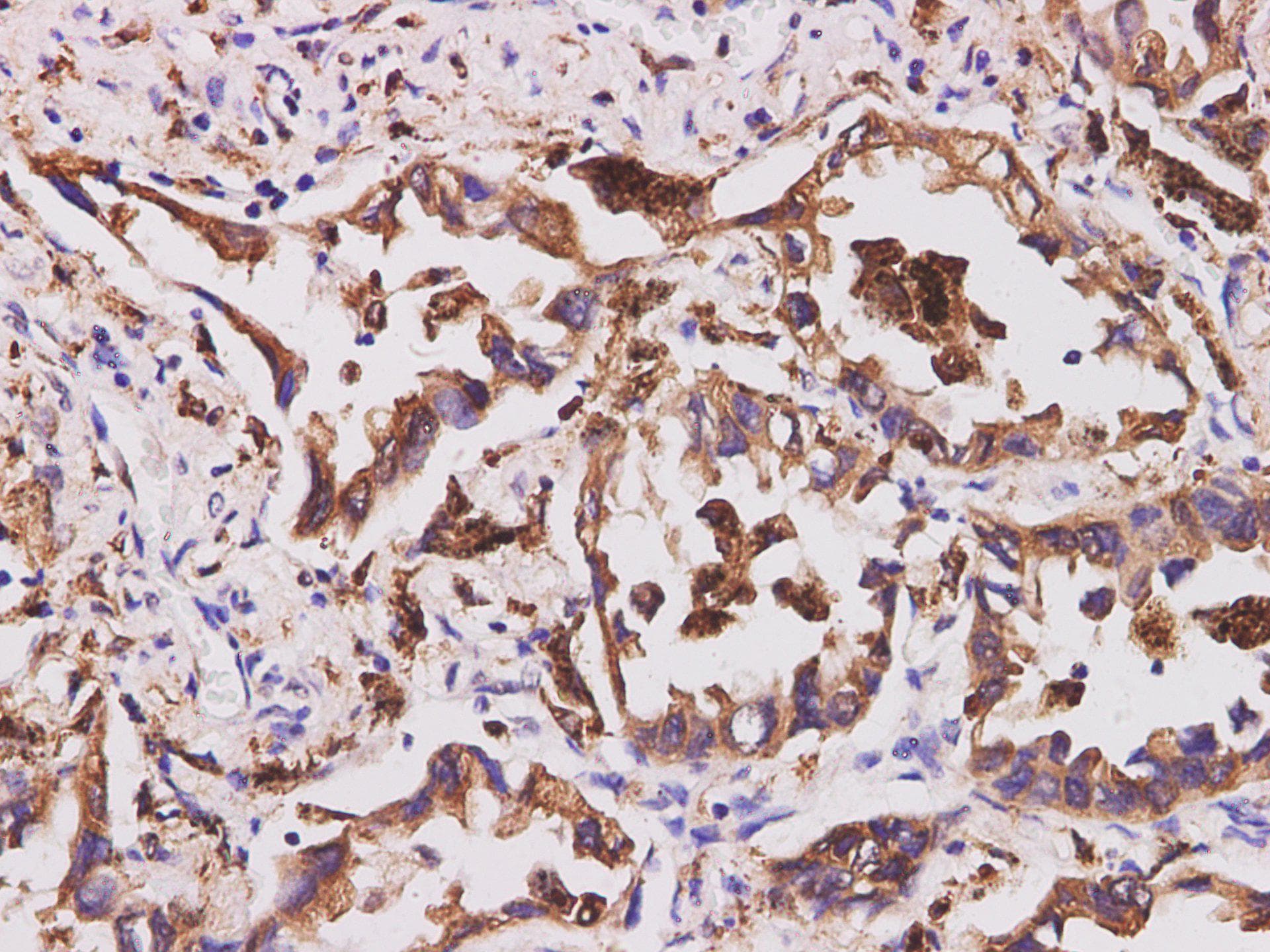 CD74 / CLIP Antibody