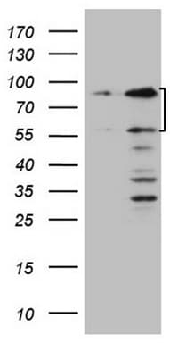 Monoclonal Mouse anti-Human SP110 Antibody (clone OTI4C1, Carrier-free, aa232-521, IHC, WB)