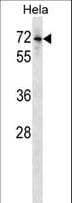 ALK-6 / BMPR1B Antibody (aa133-160)