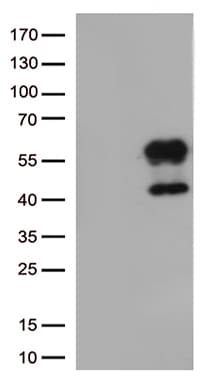 HAVCR2 / TIM-3 Antibody (clone OTI1D6, Carrier-free)