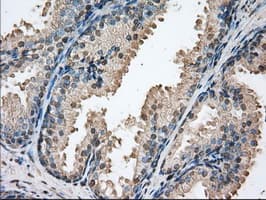 PIM2 / Pim-2 Antibody (clone OTI9A5)