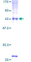 Human TMEM59 Protein (Recombinant GST)
