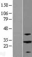 ABHD12B Protein (Over-Expression Lysate Myc-DDK (Flag))