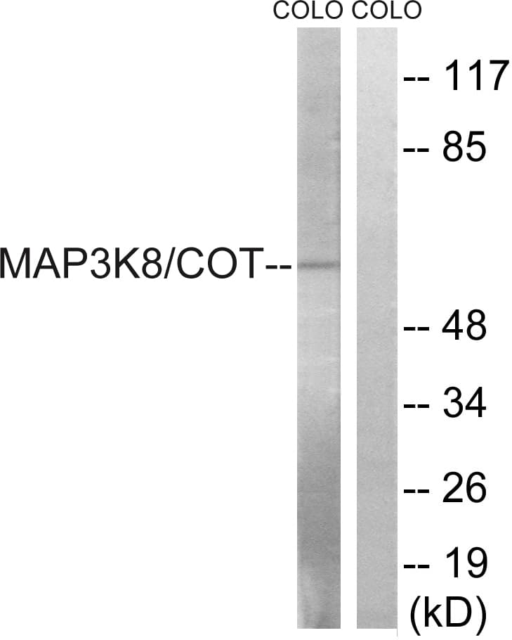 MAP3K8 / TPL2 Antibody (aa366-415)