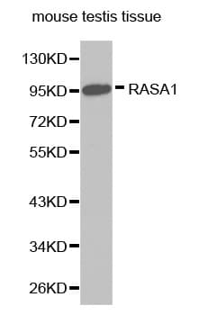Polyclonal Rabbit anti-Human RASA1 Antibody (IHC, WB)