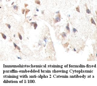 Polyclonal Rabbit anti-Human CTNNA2 / Alpha-2 Catenin Antibody (IHC)