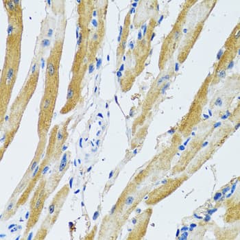 Polyclonal Rabbit anti-Human GDAP1 Antibody (IHC, WB)