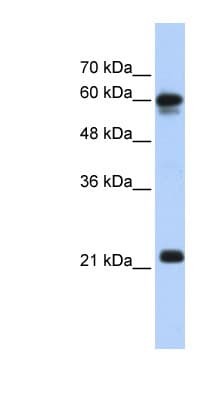 SEMA4F / Semaphorin 4F Antibody (aa91-140)