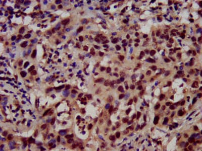 Polyclonal Rabbit anti-Human HIST1H3A Antibody (IHC)