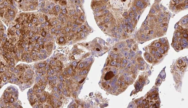 NT5E / eNT / CD73 Antibody
