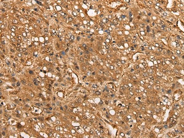 CALML6 Antibody