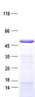 Human IP6K3 Protein (Recombinant His, N-Terminal)