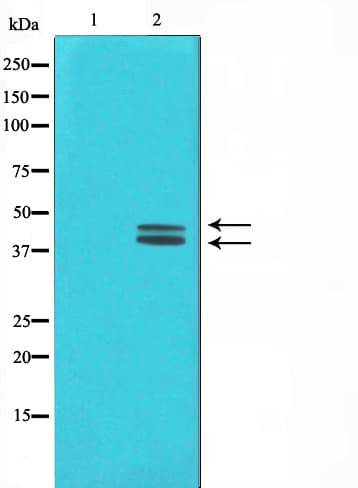 Polyclonal Rabbit anti-Human MAPK3 / ERK1 Antibody (IHC, IF, WB)