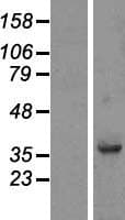 FAM118B Protein (Over-Expression Lysate Myc-DDK (Flag))