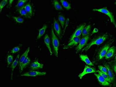 WBSCR28 Antibody