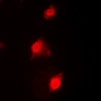 Polyclonal Rabbit anti-Human RAD51C Antibody (Internal, IHC, IF, WB)