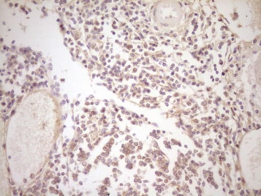 TFPI / LACI Antibody (aa29-304, clone OTI4H9, Carrier-free)