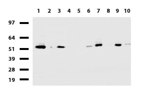 DDX56 Antibody (aa323-547, clone UMAB152)