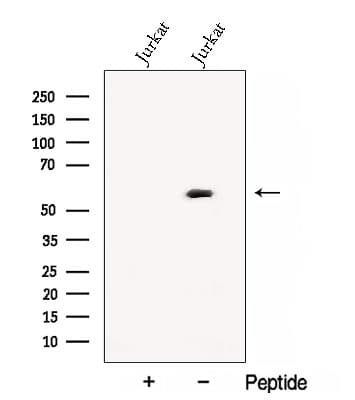 CNOT6 Antibody