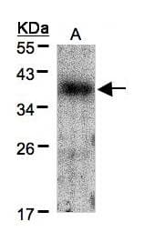 Polyclonal Rabbit anti-Human CRK Antibody (IF, WB)