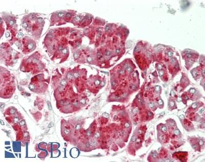 IHC-plus™ CPA1 / Carboxypeptidase A Antibody (aa301-350)