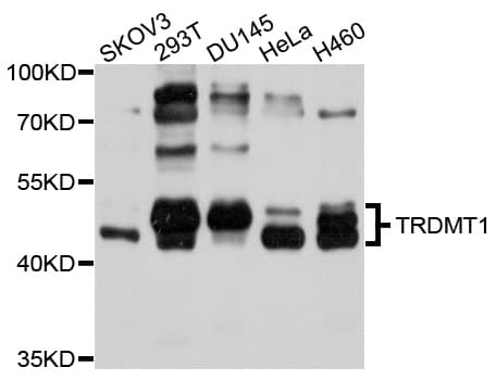 Polyclonal Rabbit anti-Human TRDMT1 / DNMT2 Antibody (WB)