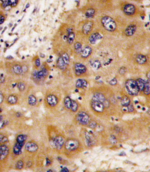 HMT / HNMT Antibody (aa29-58)