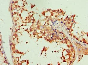 ITGB3 / Integrin Beta 3 / CD61 Antibody (aa609-788)