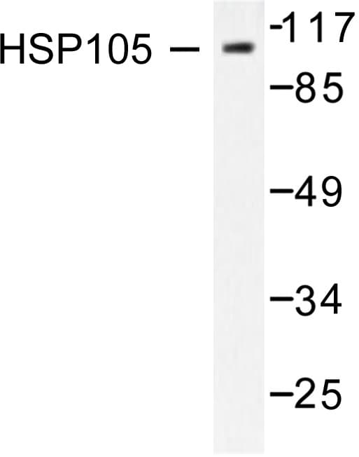 HSPH1 / HSP105 Antibody (Pro819)