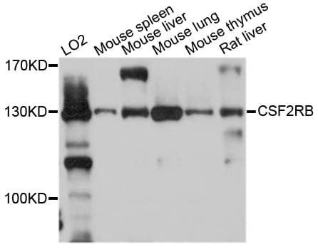 Polyclonal Rabbit anti-Human CSF2RB / CD131 Antibody (WB)