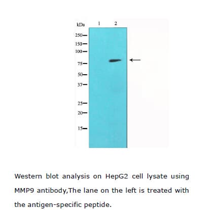 Polyclonal Rabbit anti-Human MMP9 / Gelatinase B Antibody (IHC, IF, WB)