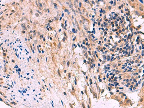 Polyclonal Rabbit anti-Human KCNIP1 / KCHIP1 Antibody (IHC)