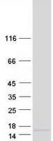 Human C10orf35 Protein (Recombinant Myc-DDK (Flag))