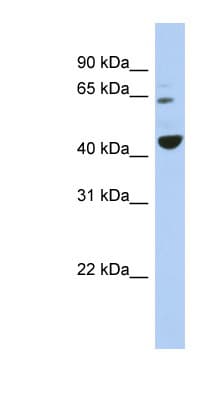 Polyclonal Rabbit anti-Human TFE3 Antibody (aa503-552, WB)