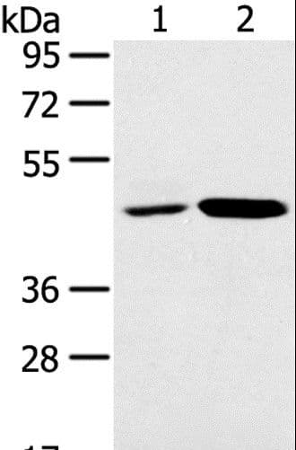 SNX5 Antibody