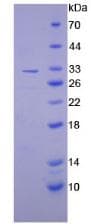 Mouse SERPINB2 / PAI-2 Protein (Recombinant His, N-Terminal)