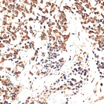 Polyclonal Rabbit anti-Human MCM5 Antibody (IHC, WB)