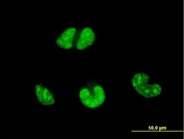 Monoclonal Mouse anti-Human ESR2 / ER Beta Antibody (clone 3F3, IF, WB)