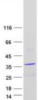 Human PANK1 / PANK Protein (Recombinant Myc-DDK (Flag))