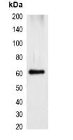 Monoclonal Mouse mStrawberry Tag Antibody (WB)