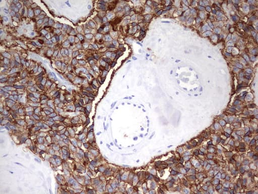 EPCAM Antibody (clone UMAB131, Carrier-free)
