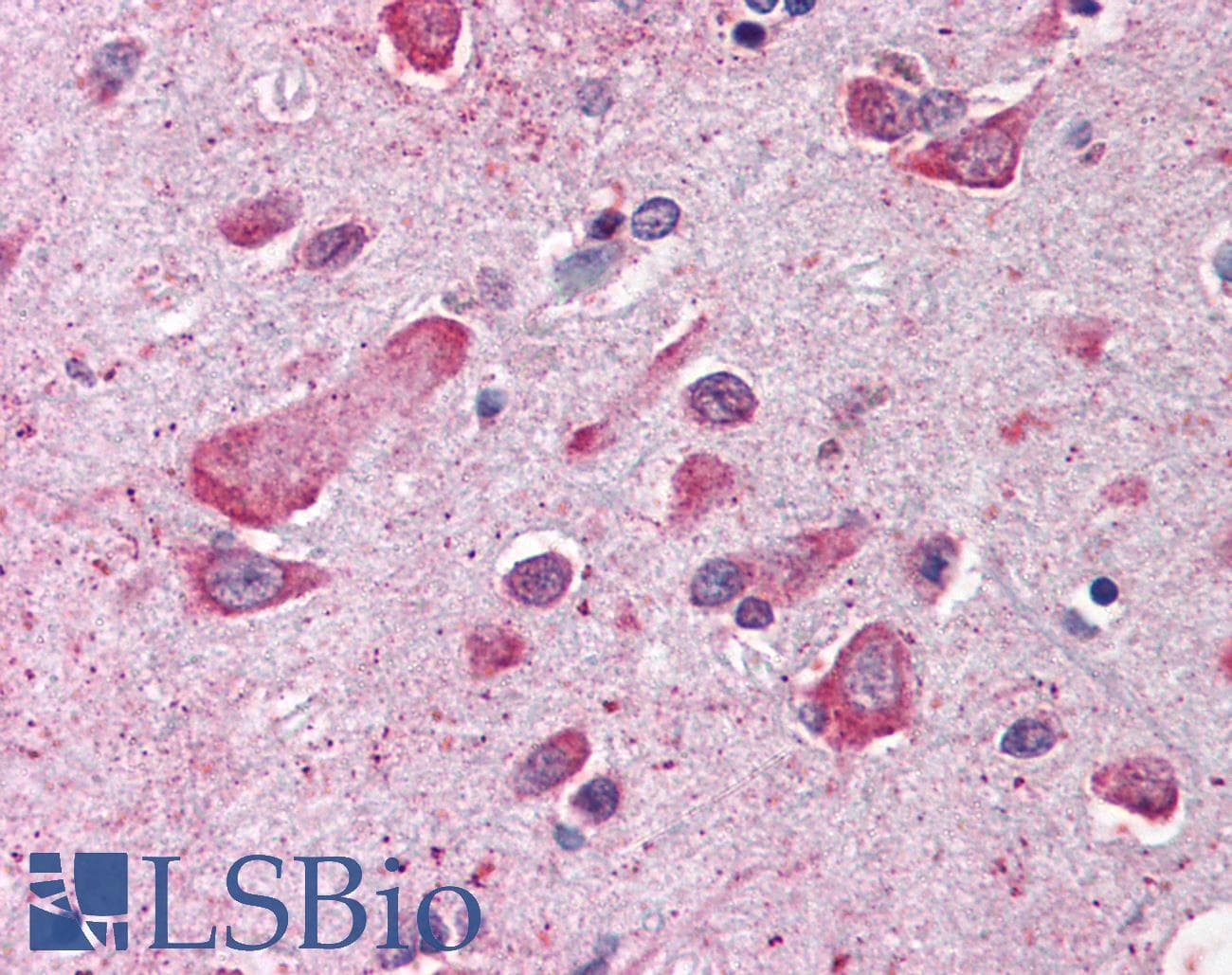 IHC-plus™ CUL1 / Cullin 1 Antibody (aa750-776)