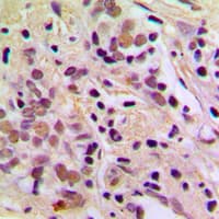 Polyclonal Rabbit anti-Human AATF Antibody (N-Terminus, IHC, IF, WB)