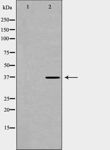 Polyclonal Rabbit anti-Human PAWR / PAR4 Antibody (IHC, IF, WB)
