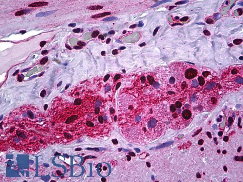 IHC-plus™ Polyclonal Rabbit anti-Human STAT1 Antibody (phospho-Ser727, IHC, WB)
